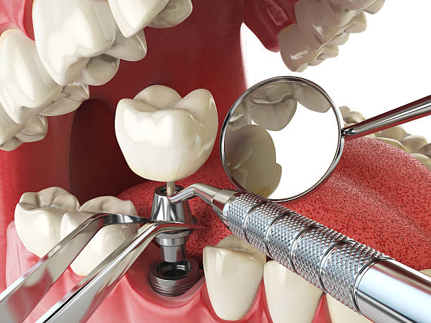 Best Urgent Dental Care for Toothache in Guthrie Center, IA